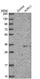 Western blot analysis in control (vector only transfected HEK293T lysate) and ACRV1 over-expression lysate (Co-expressed with a C-terminal myc-DDK tag (~3.1 kDa) in mammalian HEK293T cells, LY412644).