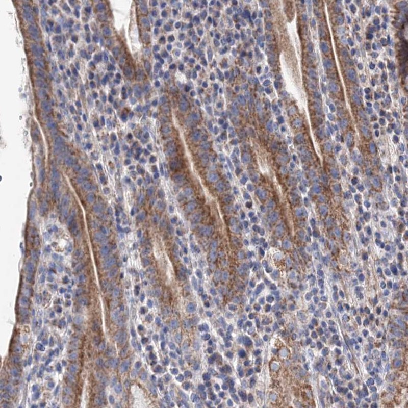 Anti-YARS2 Antibody