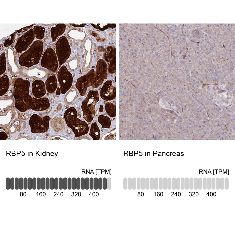 Anti-RBP5 Antibody