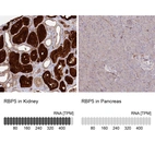 Anti-RBP5 Antibody
