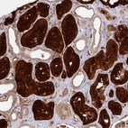Immunohistochemical staining of human kidney shows high expression.