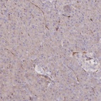 Immunohistochemical staining of human pancreas shows low expression as expected.