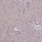 Immunohistochemical staining of human pancreas shows low expression as expected.