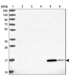 Lane 1: Marker [kDa] 250, 130, 95, 72, 55, 36, 28, 17, 10_br/_Lane 2: Human cell line RT-4_br/_Lane 3: Human cell line U-251MG sp_br/_Lane 4: Human plasma (IgG/HSA depleted)_br/_Lane 5: Human liver tissue_br/_Lane 6: Human tonsil tissue