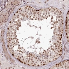 Anti-THYN1 Antibody