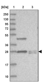 Lane 1: Marker [kDa] 250, 130, 95, 72, 55, 36, 28, 17, 10_br/_Lane 2: Human cell line RT-4_br/_Lane 3: Human cell line U-251MG sp