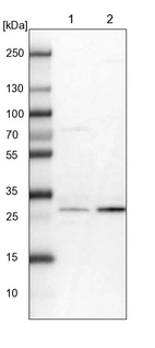 Lane 1: NIH-3T3 cell lysate (Mouse embryonic fibroblast cells)_br/_Lane 2: NBT-II cell lysate (Rat Wistar bladder tumour cells)