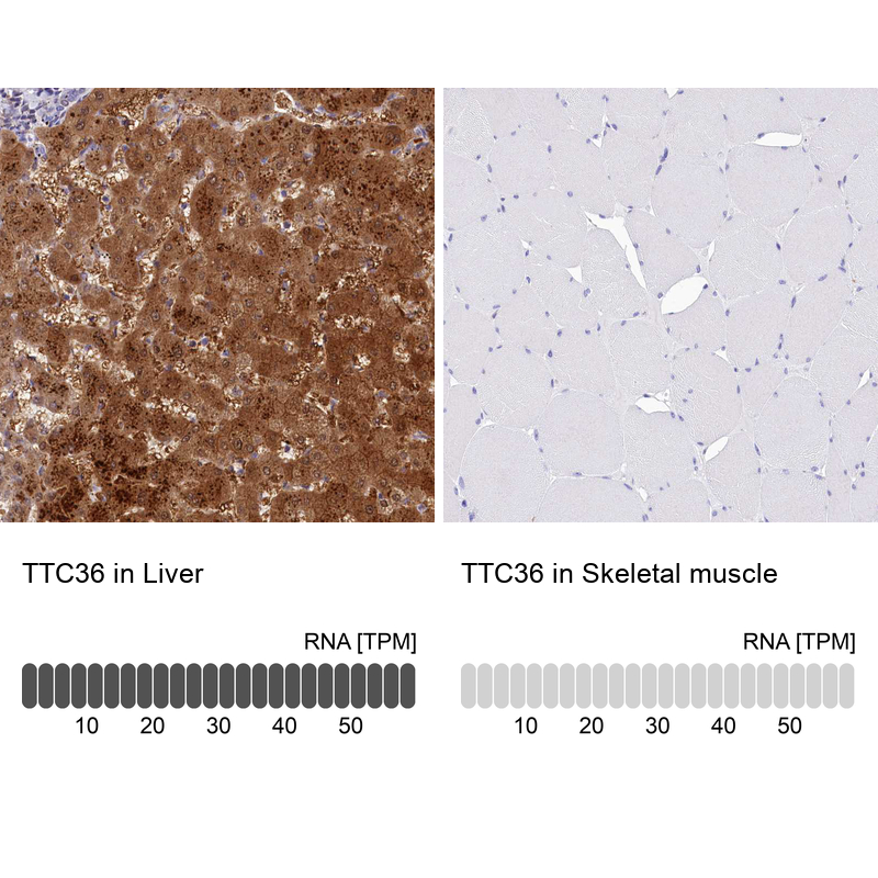 Anti-TTC36 Antibody