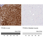 Anti-TTC36 Antibody