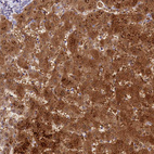 Immunohistochemical staining of human liver shows strong cytoplasmic positivity in hepatocytes.