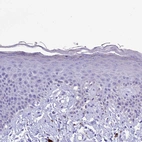 Immunohistochemical staining of human skin shows no positivity in squamous epithelial cells as expected.
