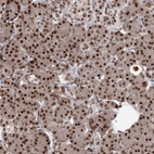 Anti-THYN1 Antibody