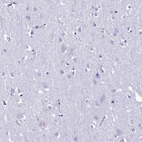 Immunohistochemical staining of human cerebral cortex shows no positivity in neurons as expected.