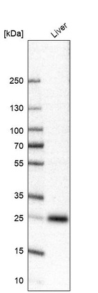 Anti-TTC36 Antibody