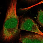 Immunofluorescent staining of human cell line U-251 MG shows localization to nucleus, nucleoli fibrillar center & cytosol.
