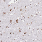 Immunohistochemical staining of human cerebral cortex shows moderate cytoplasmic positivity in neurons.