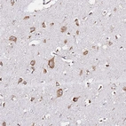 Immunohistochemical staining of human cerebral cortex shows moderate cytoplasmic positivity in neurons.