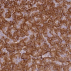 Immunohistochemical staining of human pancreas shows strong cytoplasmic positivity in exocrine glandular cells.