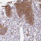 Immunohistochemical staining of human skin shows moderate cytoplasmic positivity in squamous epithelial cells.