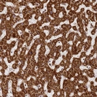 Immunohistochemical staining of human liver shows strong granular cytoplasmic positivity in hepatocytes.