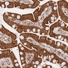 Immunohistochemical staining of human small intestine shows strong granular cytoplasmic positivity in glandular cells.