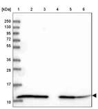 Lane 1: Marker [kDa] 250, 130, 95, 72, 55, 36, 28, 17, 10_br/_Lane 2: Human cell line RT-4_br/_Lane 3: Human cell line U-251MG sp_br/_Lane 4: Human plasma (IgG/HSA depleted)_br/_Lane 5: Human liver tissue_br/_Lane 6: Human tonsil tissue