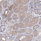 Anti-TCAF2 Antibody