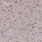 Anti-ARL8A Antibody