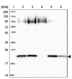 Lane 1: Marker [kDa] 250, 130, 95, 72, 55, 36, 28, 17, 10_br/_Lane 2: Human cell line RT-4_br/_Lane 3: Human cell line U-251MG sp_br/_Lane 4: Human plasma (IgG/HSA depleted)_br/_Lane 5: Human liver tissue_br/_Lane 6: Human tonsil tissue