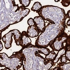 Anti-ALPP Antibody