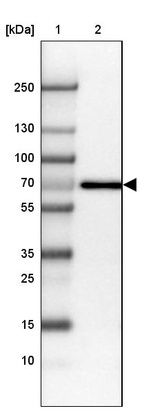 Lane 1: Marker [kDa] 250, 130, 100, 70, 55, 35, 25, 15, 10_br/_Lane 2: Human Placenta tissue