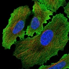 Immunofluorescent staining of human cell line HeLa shows localization to plasma membrane.