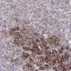 Anti-LRRC38 Antibody