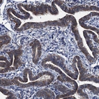 Anti-EYA4 Antibody