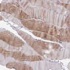 Immunohistochemical staining of human skeletal muscle shows weak to moderate cytoplasmic positivity in myocytes.
