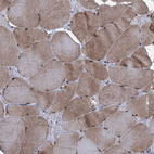 Immunohistochemical staining of human skeletal muscle shows moderate nuclear and cytoplasmic positivity in myocytes.