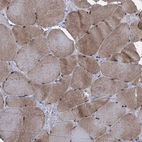 Immunohistochemical staining of human skeletal muscle shows moderate nuclear and cytoplasmic positivity in myocytes.