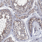 Immunohistochemical staining of human testis shows moderate nuclear positivity in a small subset of cells in seminiferous ducts.