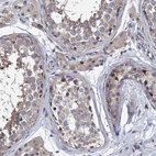 Immunohistochemical staining of human testis shows moderate nuclear positivity in a small subset of cells in seminiferous ducts.