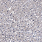 Immunohistochemical staining of human liver shows no positivity in hepatocytes as expected.