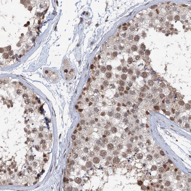 Anti-PHF8 Antibody