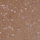Immunohistochemical staining of human cerebral cortex shows high expression.