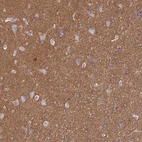 Immunohistochemical staining of human cerebral cortex shows high expression.