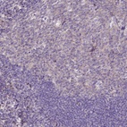Immunohistochemical staining of human tonsil shows low expression as expected.