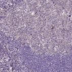 Immunohistochemical staining of human tonsil shows low expression as expected.