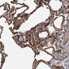 Anti-TMEM164 Antibody