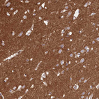Anti-CD99L2 Antibody