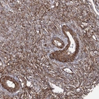 Immunohistochemical staining of human Ovary shows strong membranous positivity in follicle and stromal cells.