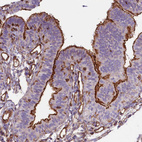 Immunohistochemical staining of human fallopian tube shows strong positivity in microvilli in glandular cells.