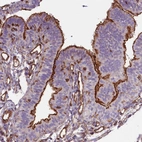 Immunohistochemical staining of human fallopian tube shows strong positivity in microvilli in glandular cells.